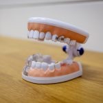 Ортодонтическая коррекция